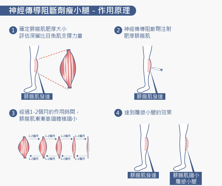 瘦大腿,瘦小腿,瘦大腿內側,大小腿整形,瘦大小腿,大小腿抽脂